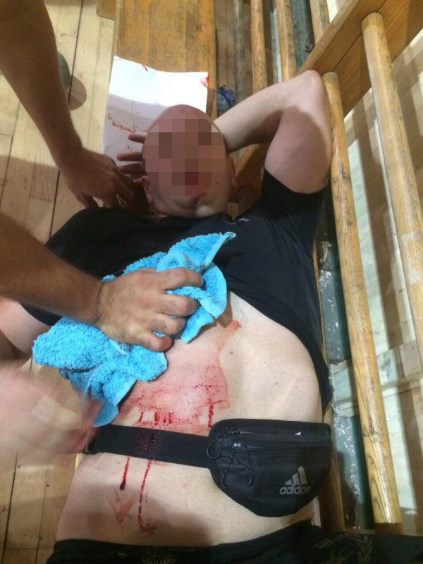 Uhapšen napadač koji je izbo nožem Nenada Đurića, trenera iz Aleksinca