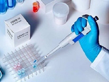Povećan broj zaraženih: Treći dan po dvoje preminulih u Srbiji, koronavirus potvrđen kod još 326 ljudi
