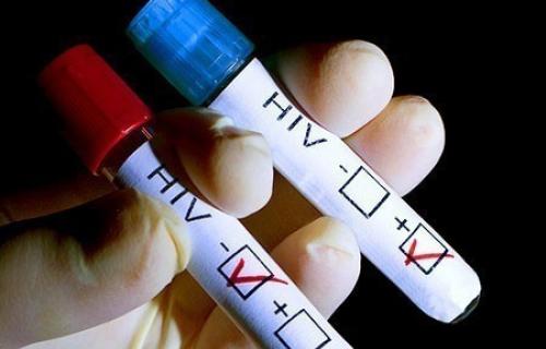 ХИВ-ом заражено 18 људи