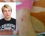 Младић из Куршумлије тврди да је физички малтретиран у прокупачкој Општој болници