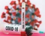 Преминуло 7 пацијената, коронавирусом заражено 3.266 особа у Србији