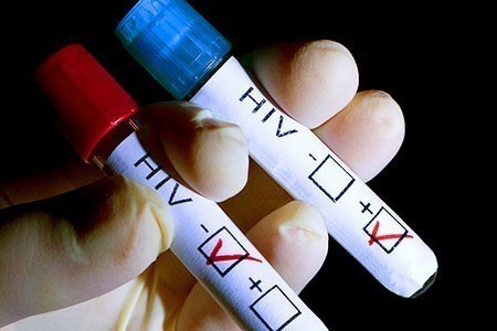 У Врању ХИВ-ом заражено 18 људи