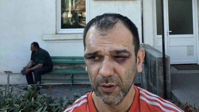 Batine u Žitorađi: Stanojević optužuje organizatore protesta, opozicija krivi predsednika opštine