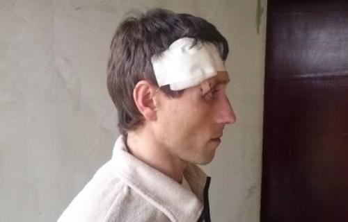 Уједао је ко права звер