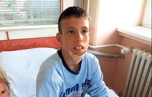 Dečaka spržila struja