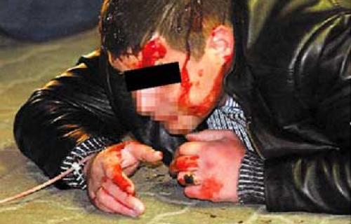 Nasilnici izbacili dečka iz diskoteke i pretukli ga
