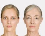 Старење коже главе и могућост рејувенције