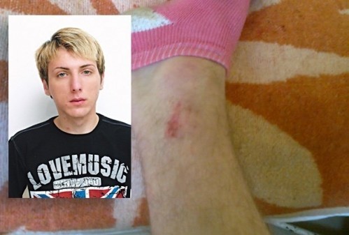 Младић из Куршумлије тврди да је физички малтретиран у прокупачкој Општој болници